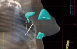 fig6