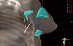 fig8