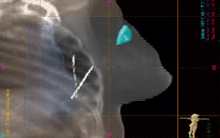 fig9
